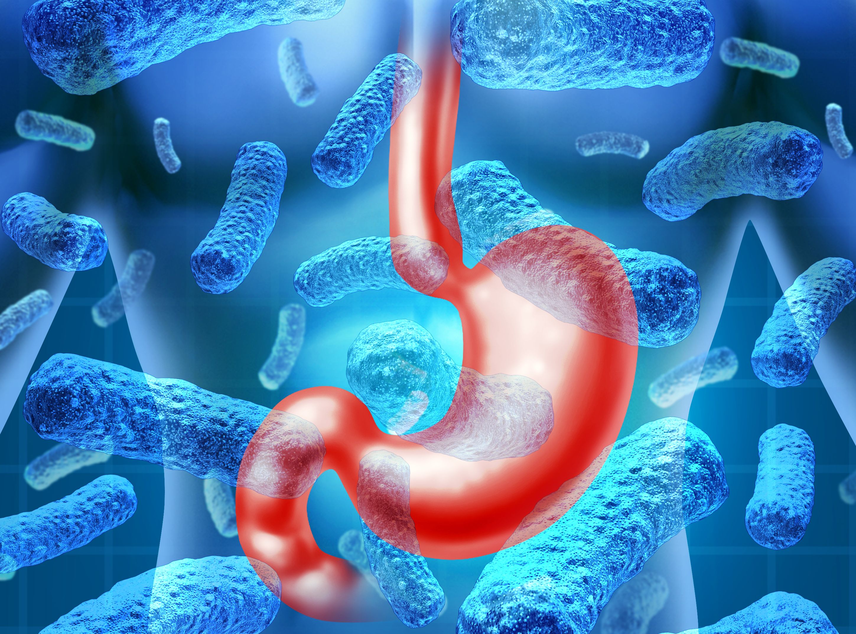 żołądek bakterie choroba wrzodowa wrzody żołądka wrzody dwunastnicy dieta łatwostrawna helicobacter pylori objawy wrzodów dieta zdrowe jelita żywienie przy wrzodach zdrowa dieta