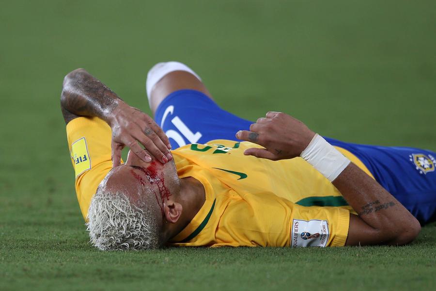 Neymar dostał z "łokcia" i zalał się krwią. Gwiazdor musiał opuścić boisko